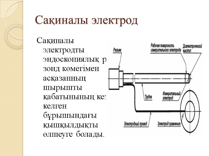 Сақиналы электрод Сақиналы электродты эндоскопиялық рН зонд көмегімен асқазанның шырышты қабатынының кез-келген бұрышындағы қышқылдықты